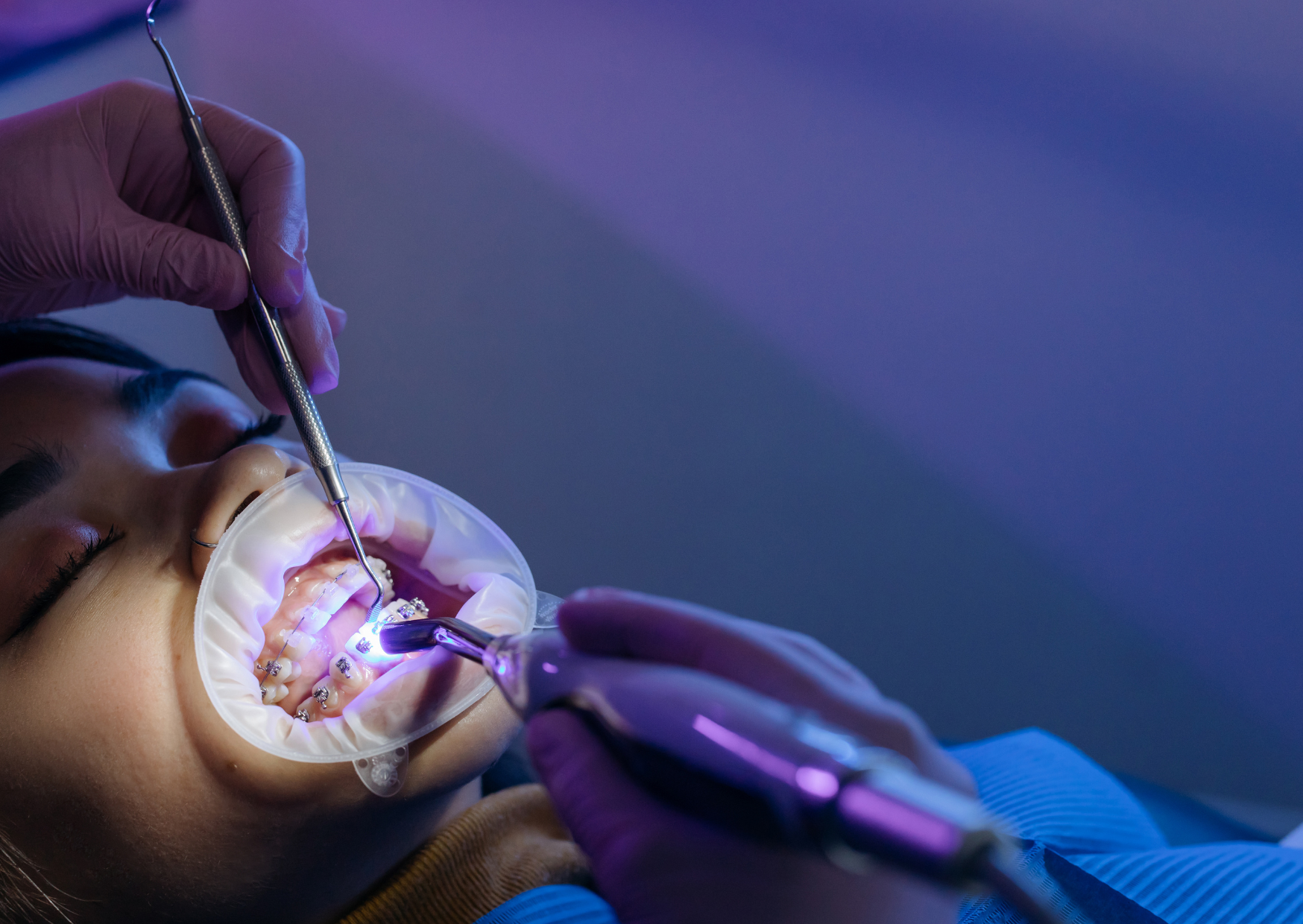 Dental Emergency in Europe 6