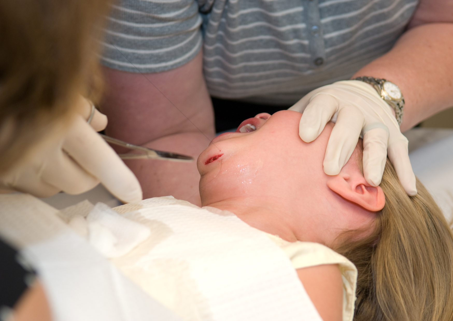 The €50 European Procedure That Costs Americans $8,000 5 laceration 2