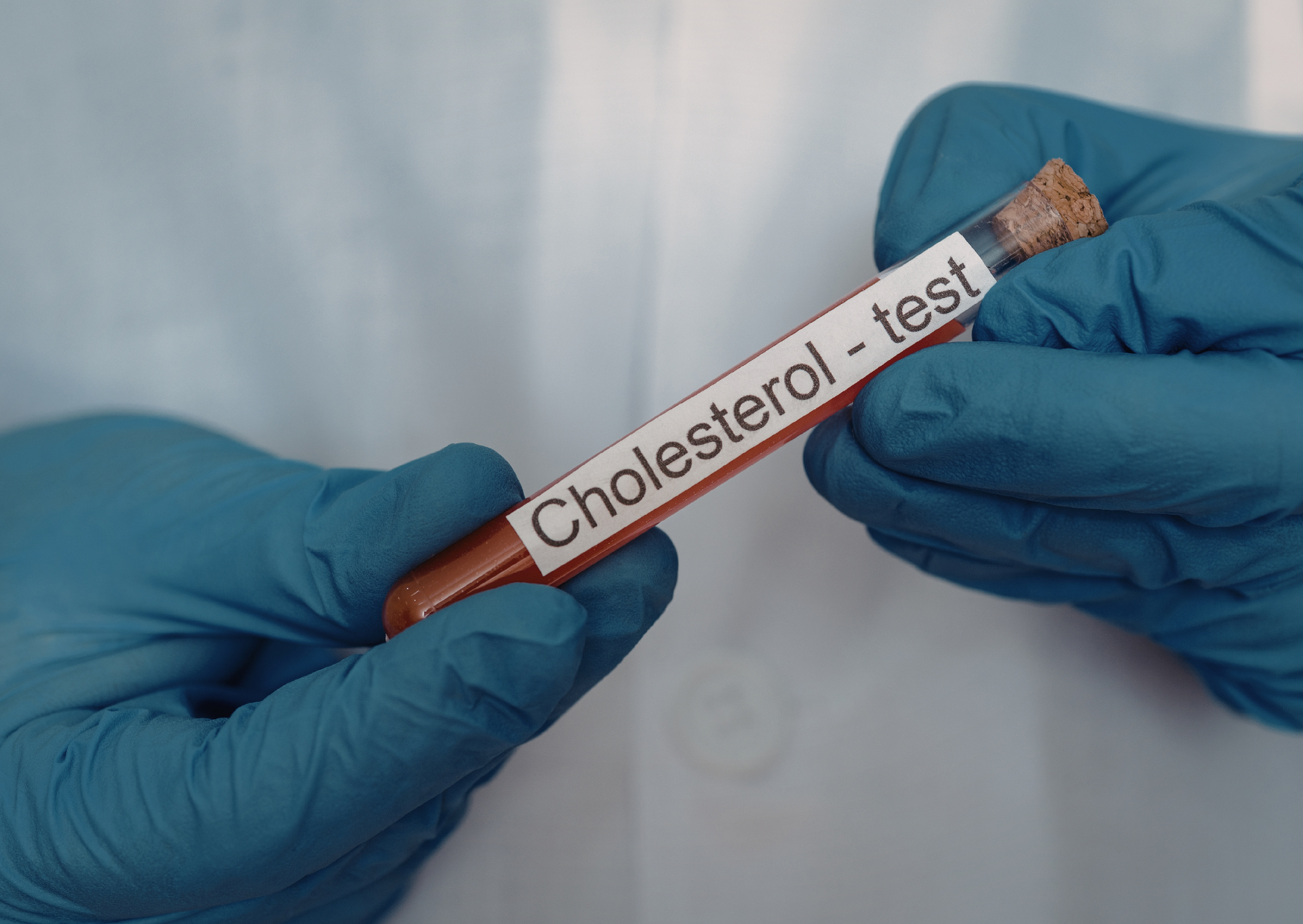 American Cholesterol Drugs Vs European Diet Changes: My 6-Month Experiment 6 cholesterol pill 2